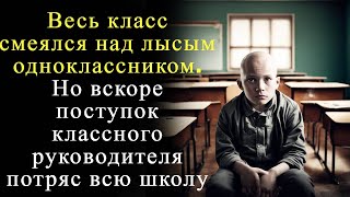 Весь класс смеялся над лысым одноклассником, но поступок педагога шокировал всех