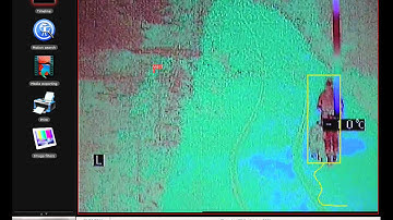 VCA with Thermal Camera