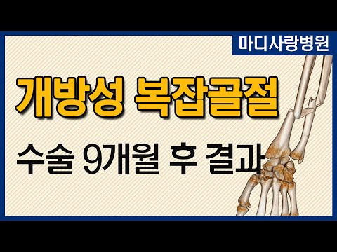 [골절 수술의 결과] 개방성 복합골절 수술 9개월 후 결과 / 요골,척골 골절