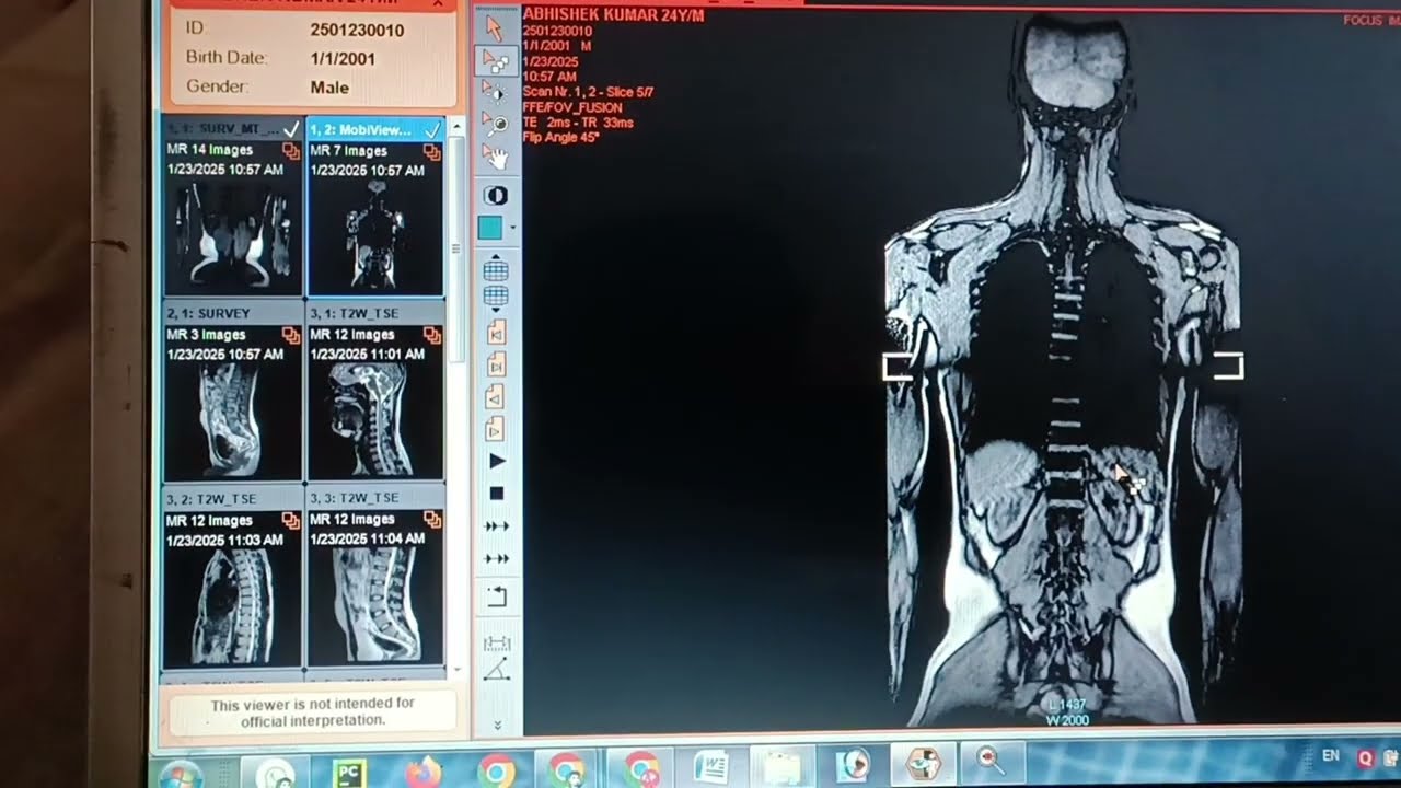 Brain mri | mri cervical spine | ms mri brain scan | Republic day celebration | Cervical spondylitis