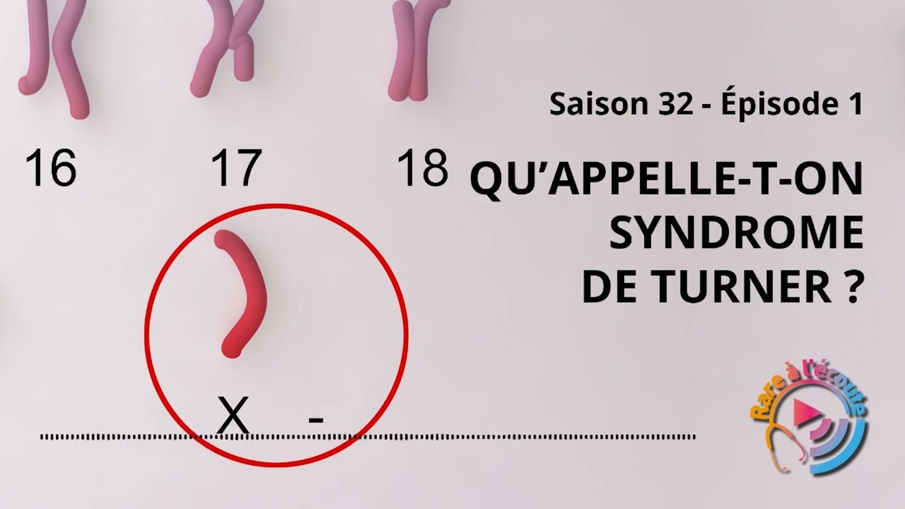 Maladie rare - Qu'appelle-t-on Syndrome de Turner ?