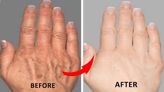 নরম তুলতুলে হাত পেয়ে যান ১ রাতেই । How to Make Your Hands Look 5 Years Younger Overnight screenshot 5