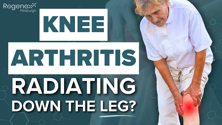 Can Knee Arthritis Pain Radiate Down The Leg? Get Help Now! | Regenexx Pittsburgh