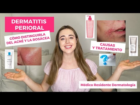 Video: Maneras fáciles de tratar la dermatitis perioral: 8 pasos (con imágenes)