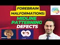 Forebrain malformation midline patterning defects