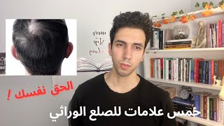 علامات الصلع ... الصلع يقترب !