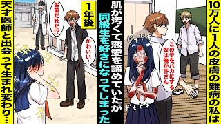 【漫画】生まれた時から10万人に１人の皮膚の難病だった私は肌をバカにされて恋愛を諦めていたがイケメン同級生に優しくされて好きになってしまった…１年後、天才医師と出会って肌が綺麗になった私は・・・