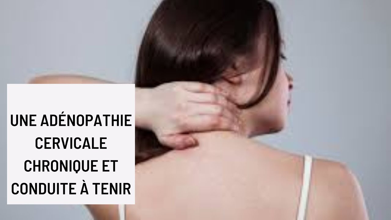 Une adénopathie cervicale chronique et conduite à tenir