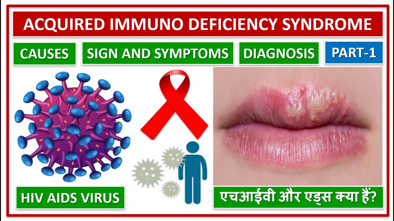 Спид голос. Stage 3: acquired Immunodeficiency Syndrome (AIDS).