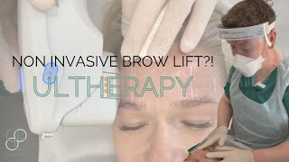 Non- Invasive *BROW LIFT* with ULTHERAPY... Does it *ACTUALLY* work ?