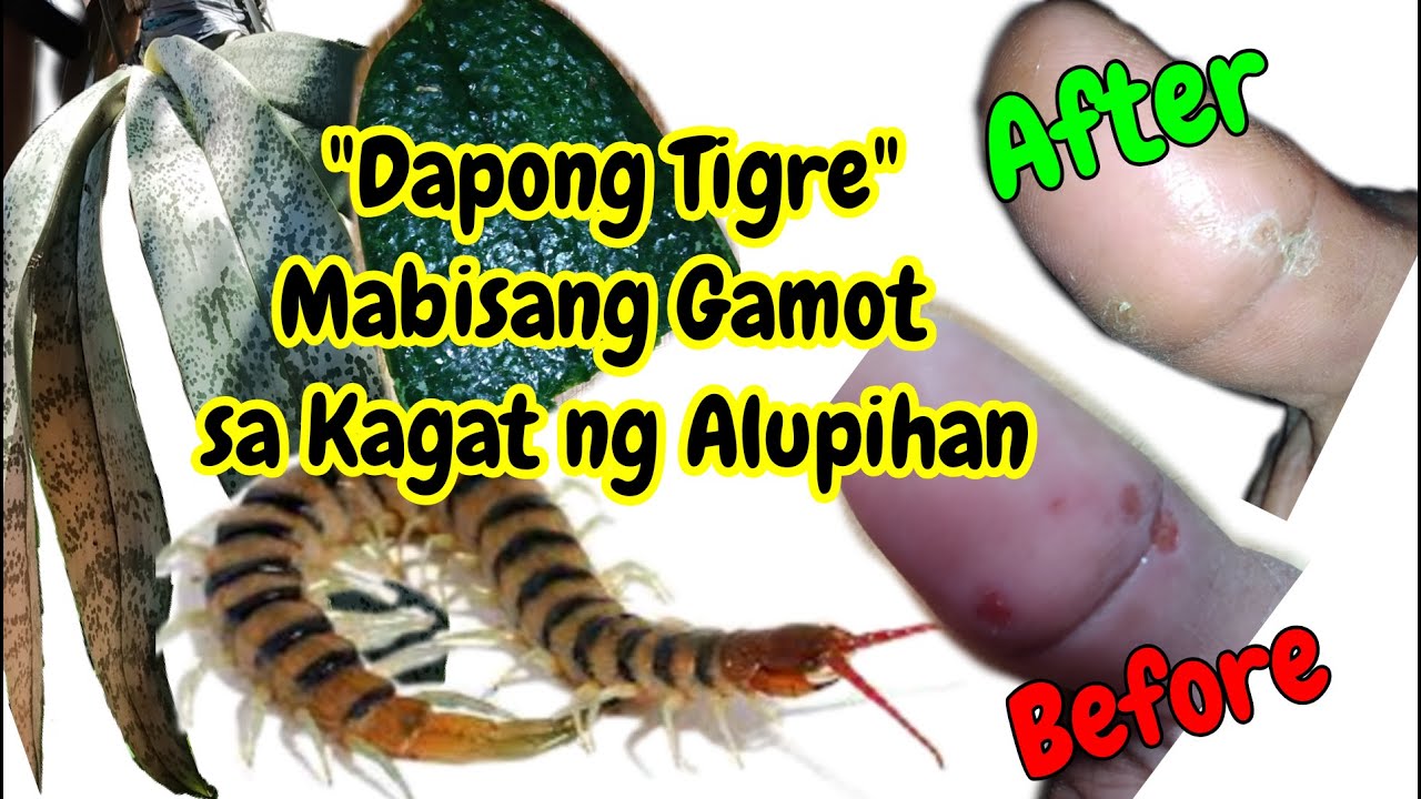 Gamot Sa Kagat Ng Daga Mabisang Gamot sa Kagat ng Alupihan(Dapong Tigre)| Centipede Bites