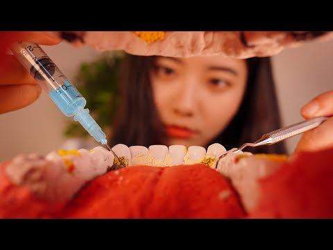 ASMR VR 치석제거 치과 롤플레이(당신은 목젖입니다) asmr scaling dentist [VR 180] 상황극