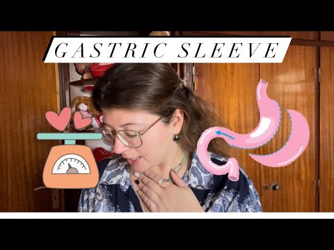 Gastric sleeve/ Γαστρικό μανίκι/Σωτηρης Γαβριήλ -Όλη η εμπειρία μου - χειρουργείο παχυσαρκίας !