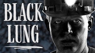 They dug their own graves | Brief Histories