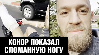 Конор рассказал правду про перелом ноги / Обращение Макгрегора к фанатам