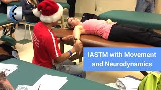 IASTM With Movement Neurodynamics