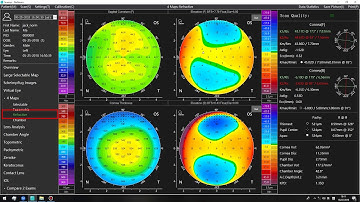 Scansys video en Español