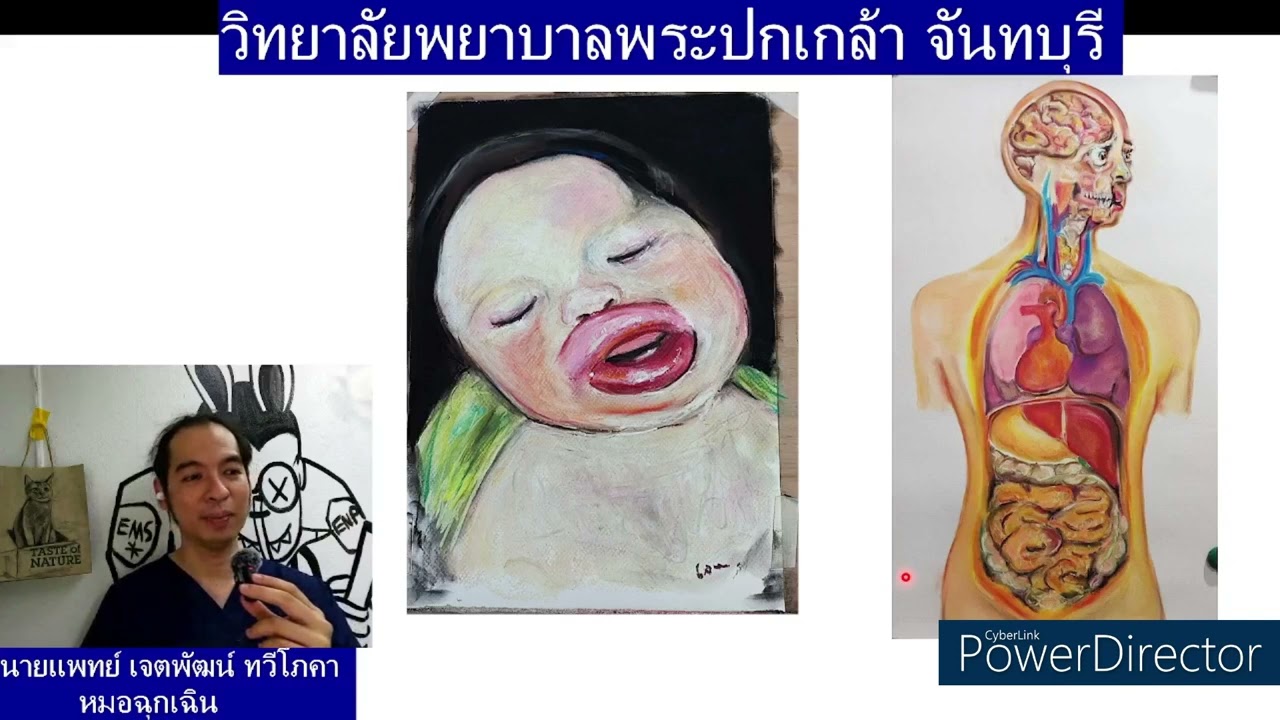 แพ้รุนแรง ตอบคอมเม้นฉุกเฉินครับ anaphylaxis