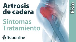 ¿Qué dolores produce la artrosis de cadera?