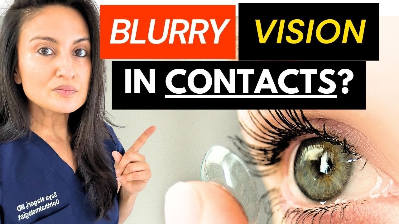 Размытое зрение при ношении контактных линз: основные причины, объясненные офтальмологом 