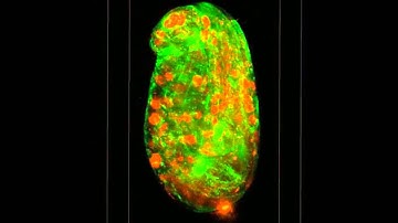 Lattice light-sheet microscopy