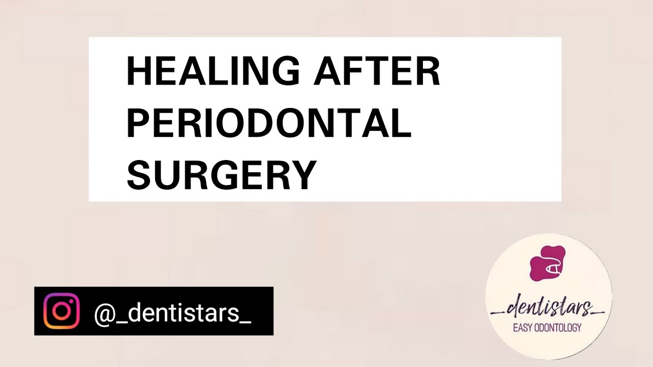 " HEALING AFTER PERIODONTAL SURGERY " YouTube