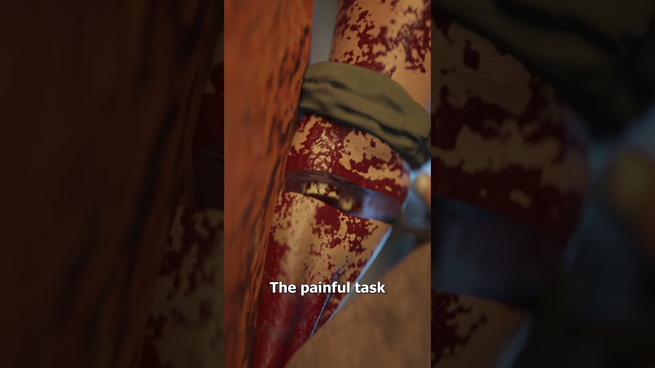 The Man Who Cut Off His Own Arm 