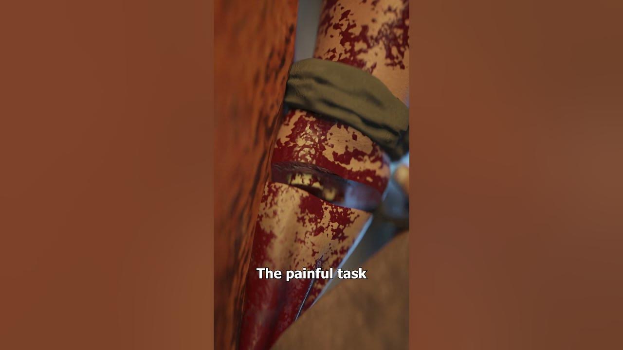 The Man Who Cut Off His Own Arm 😨