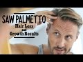 Saw palmetto hair loss  growth results