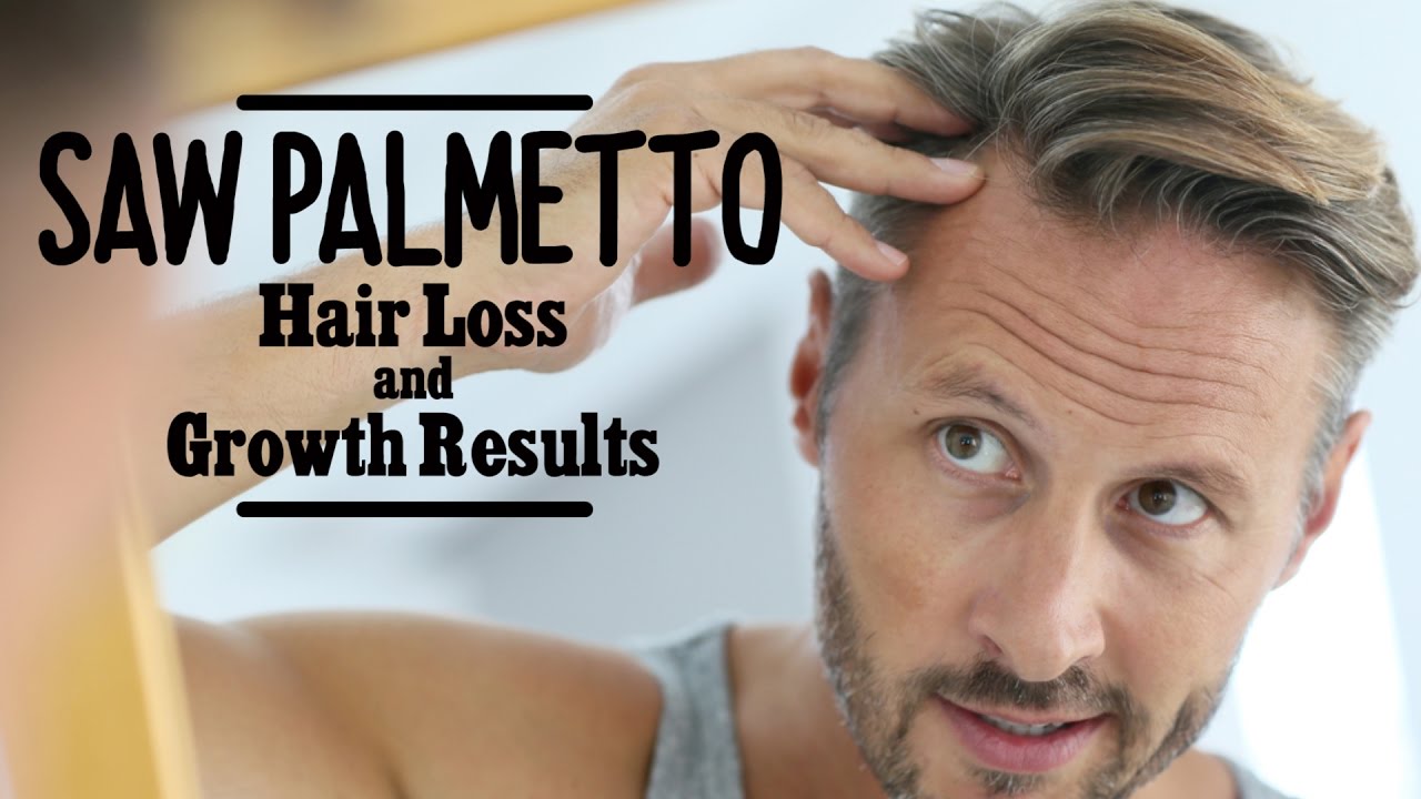 Saw Palmetto Hair Loss Growth Results YouTube