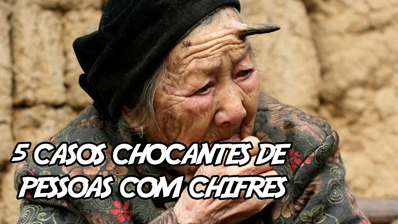 5 CASOS CHOCANTES DE PESSOAS COM CHIFRES