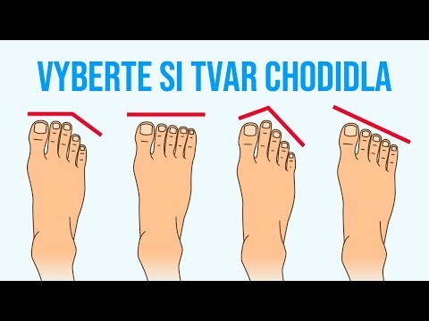 Video: Co Vás Bolí Prsty Na Nohou