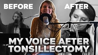 My Voice After Tonsillectomy | My Singing Before & After