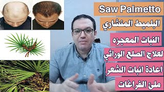 السوبالميتو / البلميط المنشاري النبات المعجزه لعلاج الصلع الوراثي واعادة انبات الشعر وملئ الفراغات