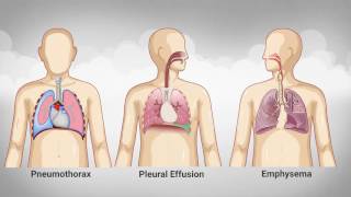 MedSim - Respiratory System Palpation