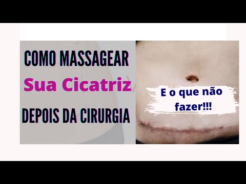 Vídeo: É possível beber kefir para diarreia - características e recomendações específicas