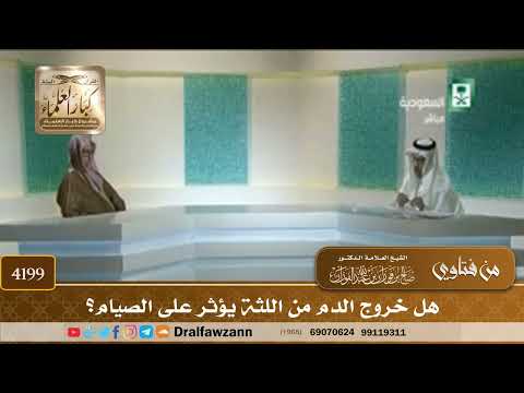 [4199] هل خروج الدم من اللثة يؤثر على الصيام؟ - صالح الفوزان
