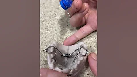 How to turn your expander (RPE) appliance