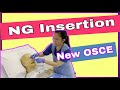 Fine Bore Nasogastric Tube OSCE 2021 | NOW 12 MINUTES