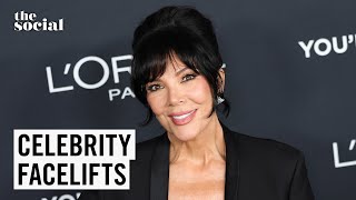 Year in Review: Are Facelifts Becoming the New Normal? | The Social @TheSocialCTV