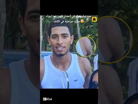 جود بيلينجهام في أحدث ظهور بعد إجراء عملية جراحية في الكتف