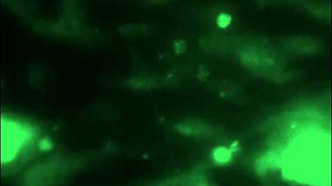 Thrombosis:  Platelet-leukocyte interaction on collagen coated biochips at  2.25 dyne/cm²