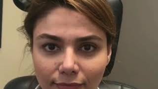 Upper Eyelid Asymmetry Correction