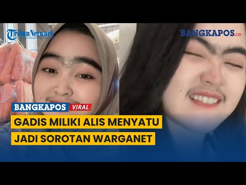 Gadis Miliki Alis Menyatu dan Kumis Lebat, Jadi Sorotan Warganet