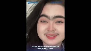 Gadis Miliki Alis Menyatu dan Kumis Lebat, Jadi Sorotan Warganet