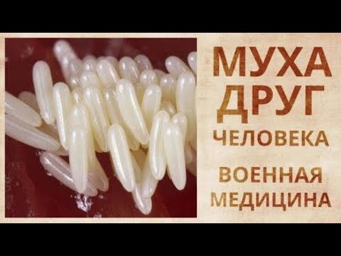 Удаление некротических тканей личинками мух