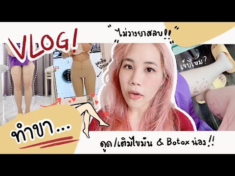 อยากขาเล็ก VLOGนี้ ไปทำขา Body Contouring ปรับรูปร่าง+Botox น่องเรียว ที่ Classy Clinic | myktbelle