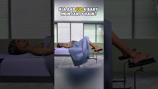 The Exact IUD Insertion Technique #healthcare #3danimation