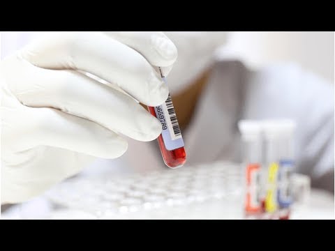 Vidéo: Monocytes Absolus: Plage Typique, Ce Que Les Résultats élevés Ou Faibles Indiquent