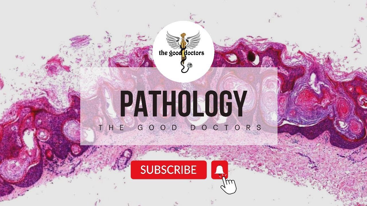 Tissue Repair - Lecture 12